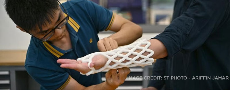 Start Up Castomize To Revolutionise Fracture Care With D Printed Cast